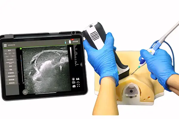Thyroid-Ablation-2